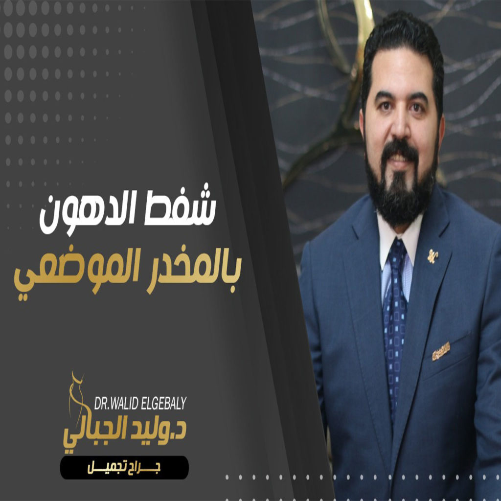 شفط الدهون | أهم مميزات العملية مع دكتور وليد الجبالي