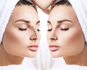 Read more about the article تغيّر شكل الوجه بعد عملية تجميل الأنف: المراحل والنتائج النهائية