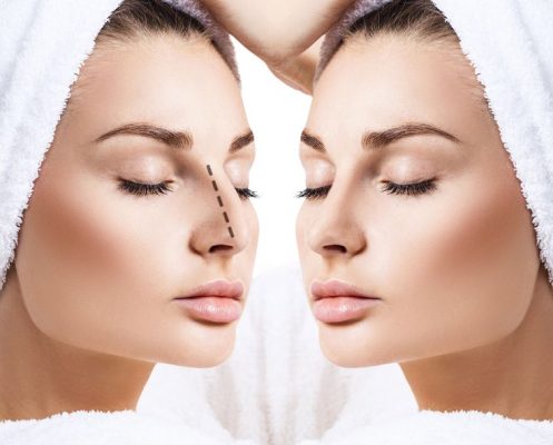 Read more about the article تغيّر شكل الوجه بعد عملية تجميل الأنف: المراحل والنتائج النهائية