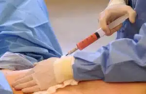 تجارب حقن الدهون الذاتية للمؤخرة كل ما تحتاجين معرفته