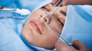 تكلفة عملية تجميل الانف في مصر مع د. وليد الجبالي، خبرة تضمن نتائج تفوق التوقعات