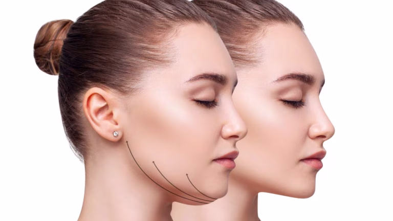 Read more about the article عملية اللغوع تجربتي من حيث الخطوات، النتائج، والتكلفة مع دكتور وليد الجبالي