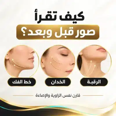 01_how_to_read_before_after