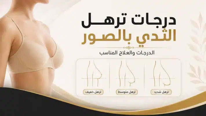 You are currently viewing درجات ترهل الثدي بالصور| 3 درجات والعلاج المناسب