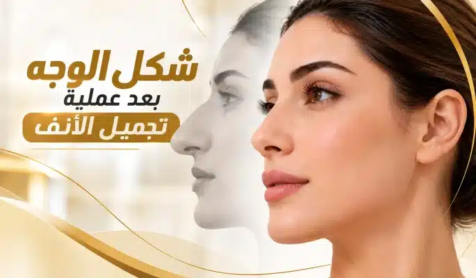Read more about the article شكل الوجه بعد عملية تجميل الأنف: متى تستقر الملامح وتظهر النتيجة؟