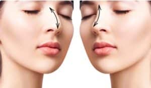 نحت الانف مع اشهر دكتور جراحة تجميل فى مصر