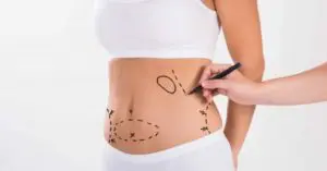 Liposuction-1-1200x628-1-300x157.jpg