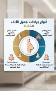أفضل جراح تجميل الأنف