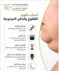 شفط دهون الذقن