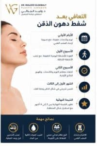 شفط دهون الذقن
