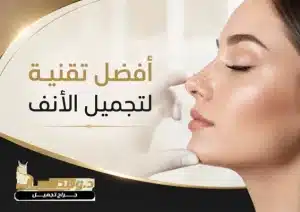أفضل تقنية لتجميل الأنف: مقارنة أحدث التقنيات والنتائج
