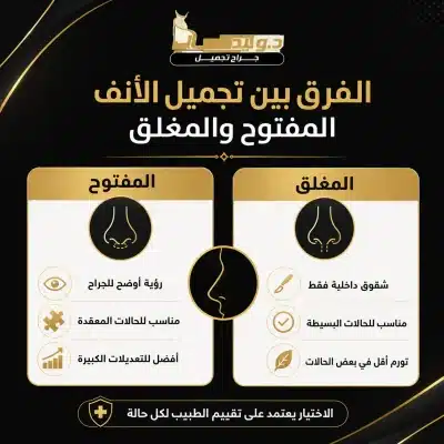 تجميل الأنف المغلق ضمن عمليات تجميل الأنف