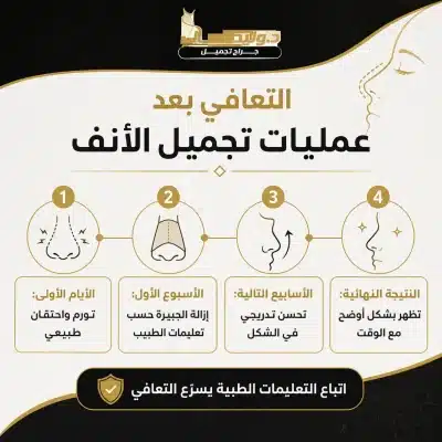التعافي بعد عمليات تجميل الأنف